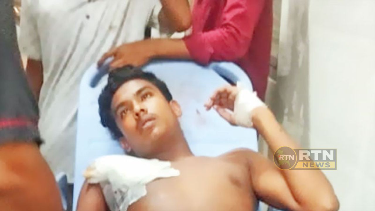 ফলোআপ চিকিৎসায় প্রশাসনিক জটিলতা, বিদেশ যেতে অপেক্ষায় জুলাই গণঅভ্যুত্থানে আহত ৬০ জন