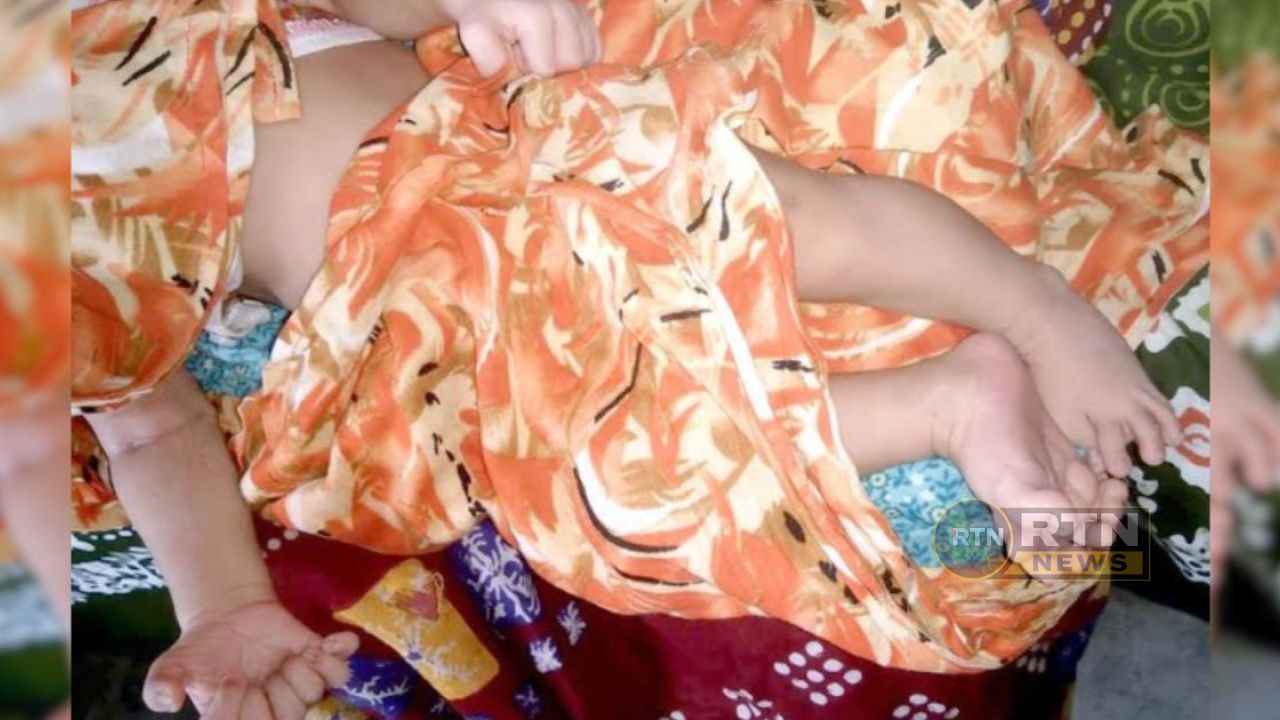 দিনাজপুরে ২৮ আঙুল নিয়ে কন্যাশিশুর জন্ম, চিকিৎসা ব্যয় নিয়ে দুশ্চিন্তায় পরিবার